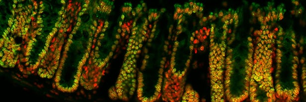 Cells in the lining of the mouse large intestine showing DNA in red and crotonylation in green